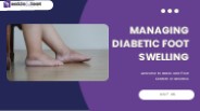 Managing Diabetic Foot Swelling