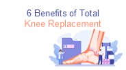 6 Benefits of Total Knee Replacement