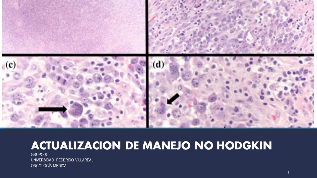 Deportes y arritmias