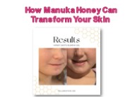 How Manuka Honey Can Transform Your Skin