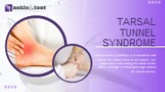 Tarsal Tunnel Syndrome Treatment