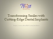 Transforming Smiles with Cutting-Edge Dental Implants