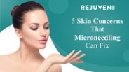 5 Skin Concerns That Microneedling Can Fix (1)