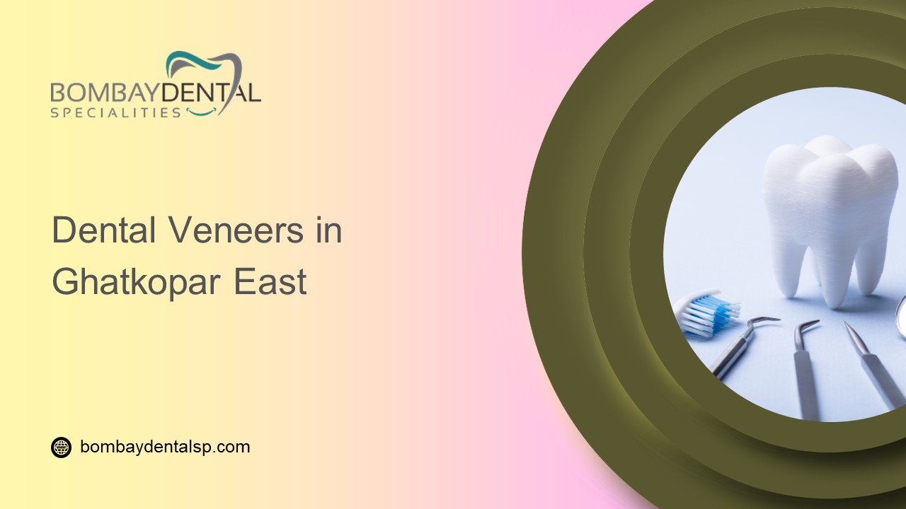 Dental Veneers in Ghatkopar East
