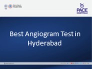 Angiogram test in Hyderabad, India