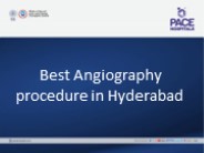 Angioplasty procedure in Hyderabad, India