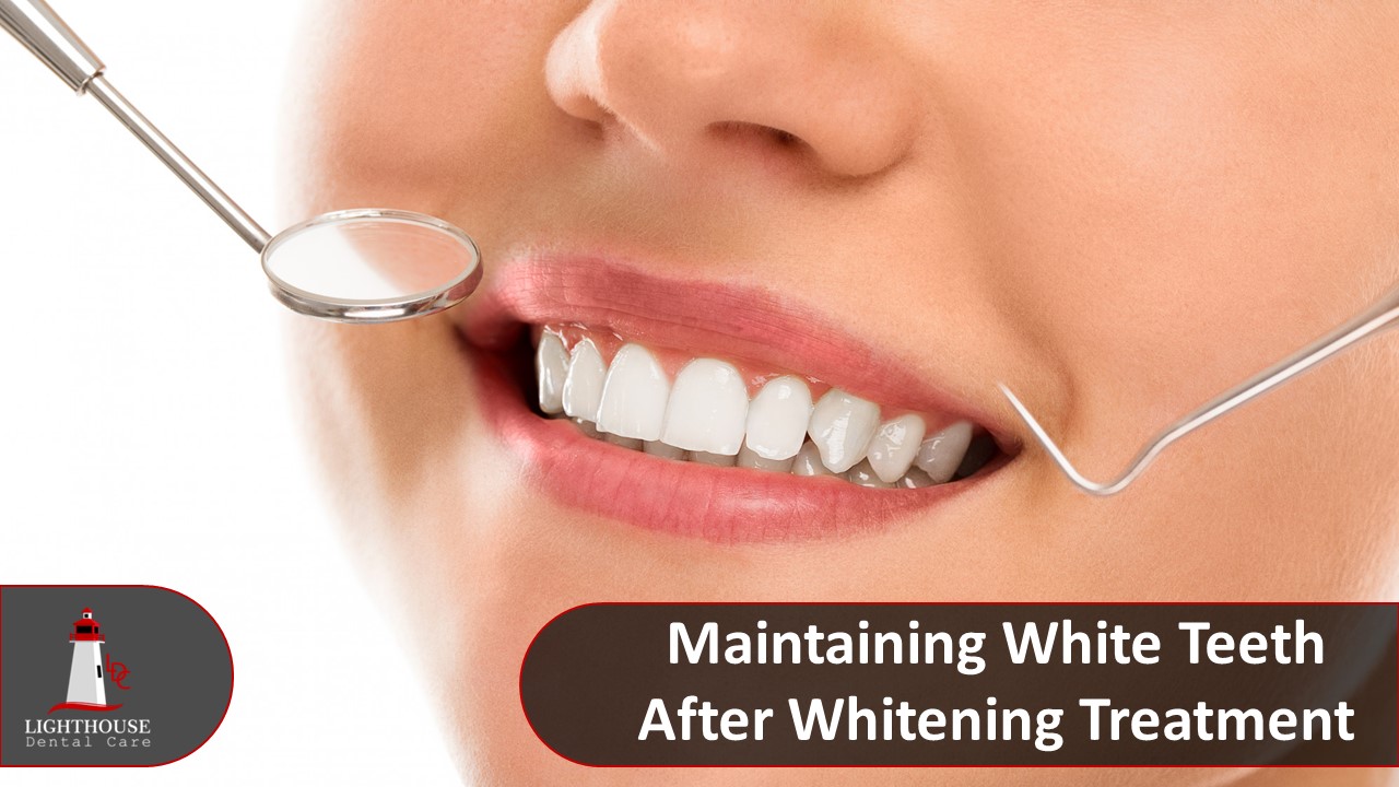 Maintaining White Teeth After Whitening Treatment