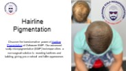 Finest Hairline Pigmentation - Delaware SMP