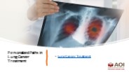 Personalized Paths in Lung Cancer Treatment