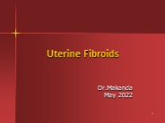 uterine fibroids