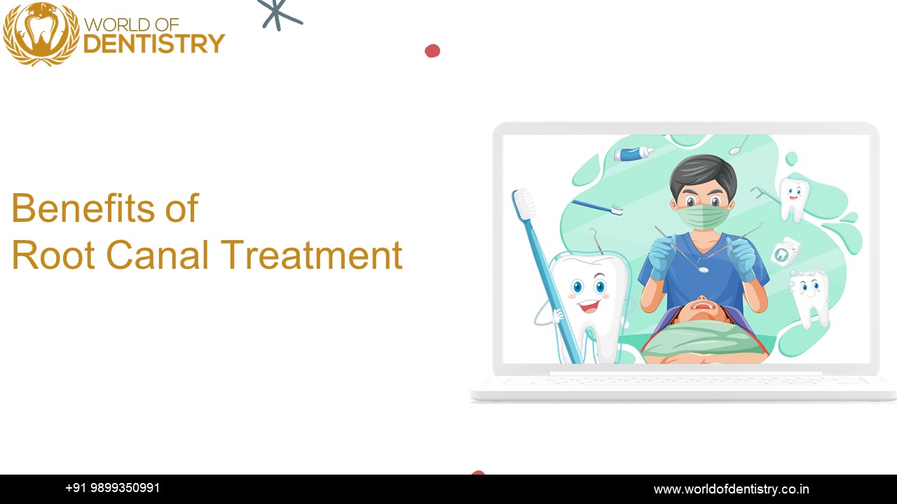 Benefits of Root canal treatment