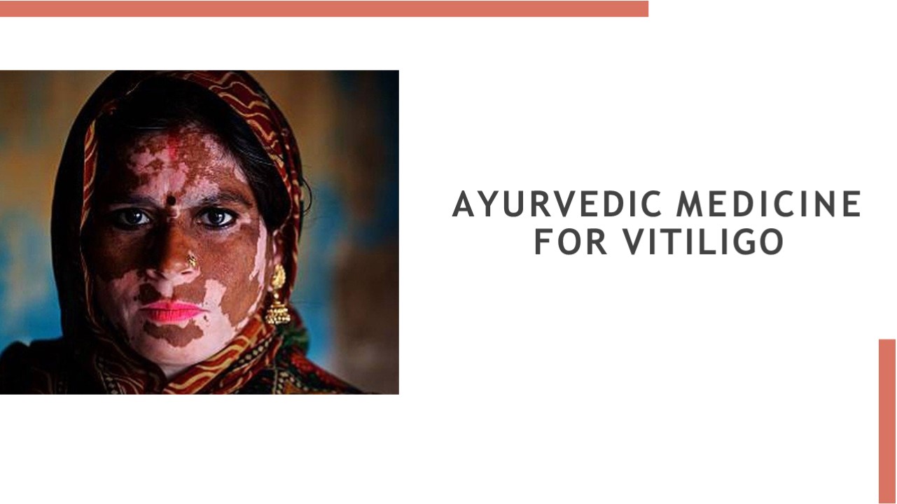 Leucoderma treatment in ayurveda presentation free