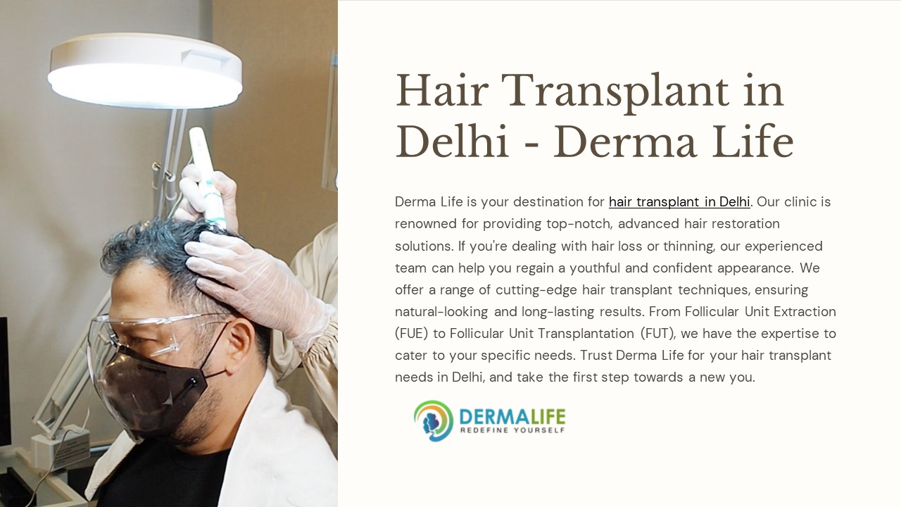 Hair transplant in Delhi