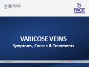 Varicose Veins: Symptoms, Causes, and Treatments