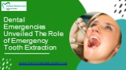 Dental Emergencies Unveiled The Role of Emergency Tooth Extraction PowerPoint PPT Presentation