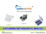 Exploring orthodontic braces