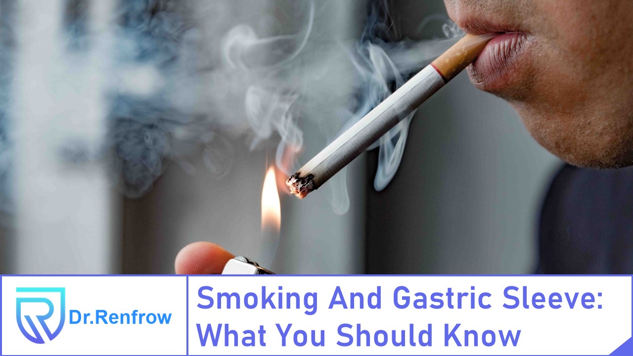 Smoking And Gastric Sleeve: What You Should Know