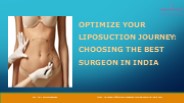 Plan Your Liposuction Surgery With Best Surgeon in India