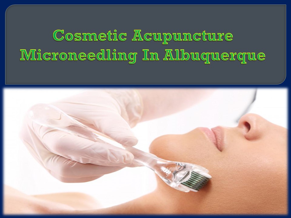 Cosmetic Acupuncture Microneedling In Albuquerque
