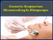 Cosmetic Acupuncture Microneedling In Albuquerque