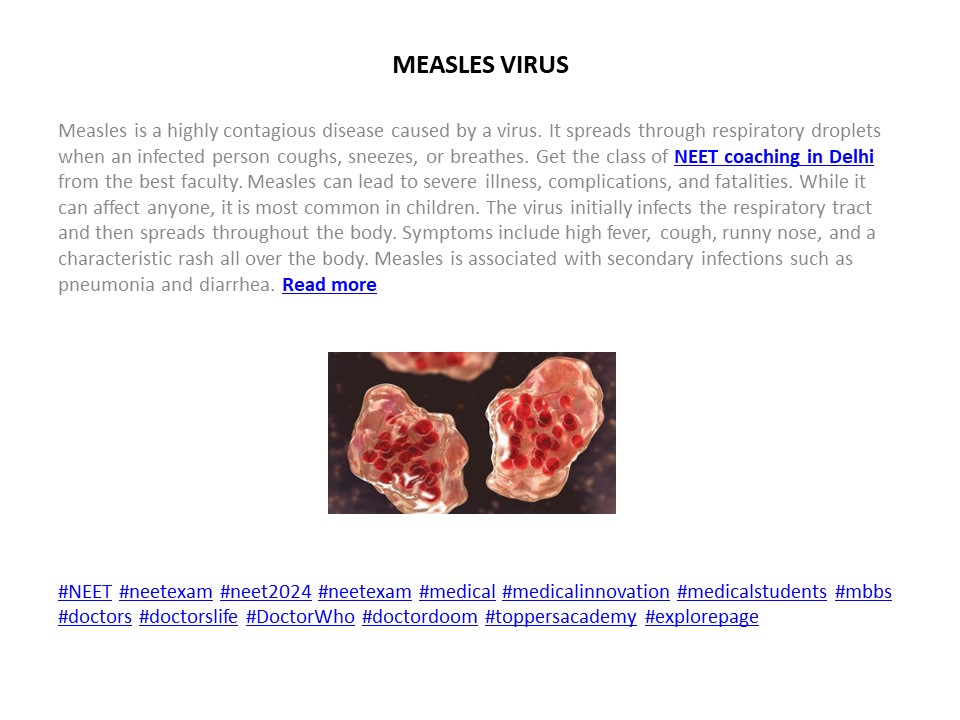 MEASLES