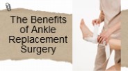 The Benefits of Ankle Replacement Surgery