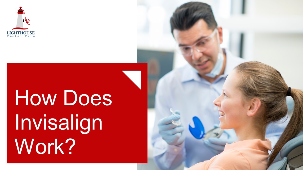 PPT How Does Invisalign Work? PowerPoint presentation free to view