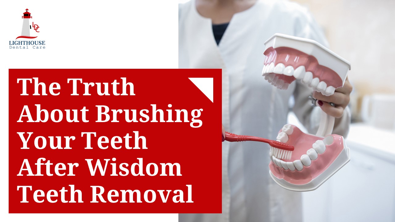 The Truth About Brushing Your Teeth After Wisdom Teeth Removal