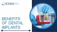 Benefits of Dental Implants