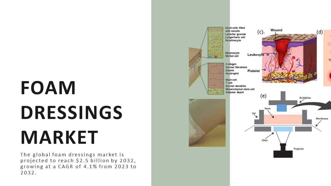 PPT foam dressings market PowerPoint presentation free to download