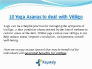 10 Yoga Asanas to deal with Vitiligo