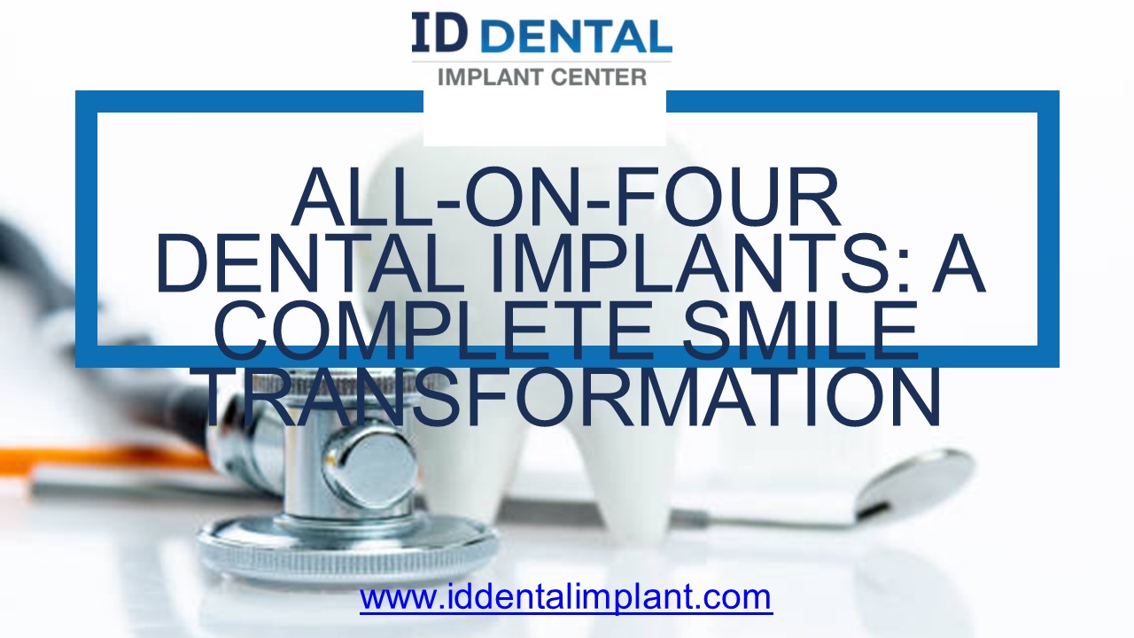 All On Four Dental Implants: A Complete Smile Transformation ...