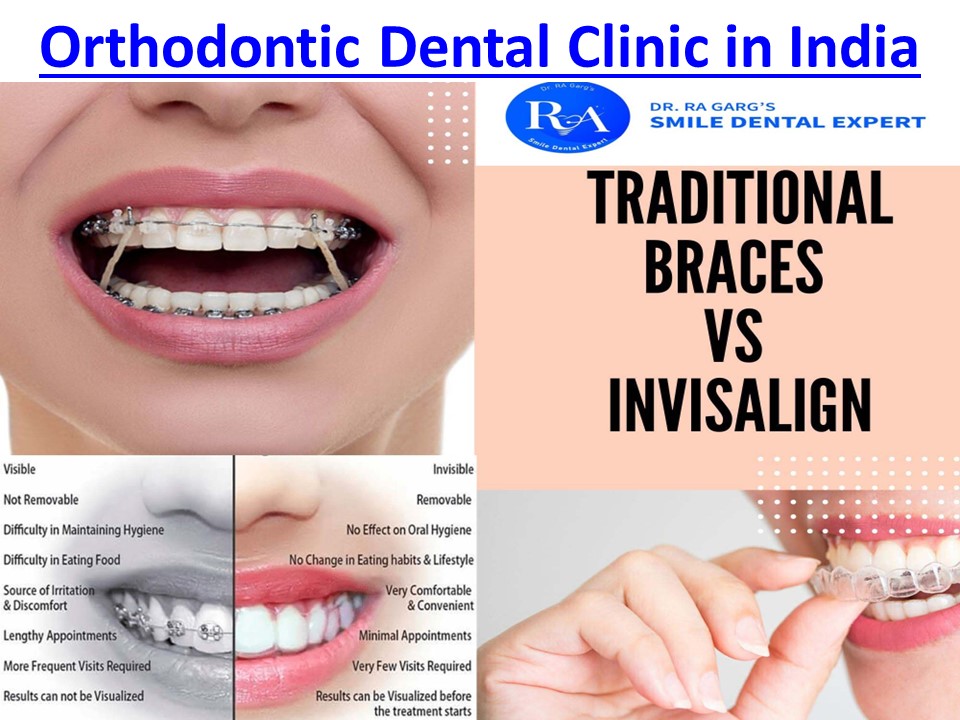 Best Dental Clinic in Faridabad For Advanced Oral Treatments into Affordable Cost