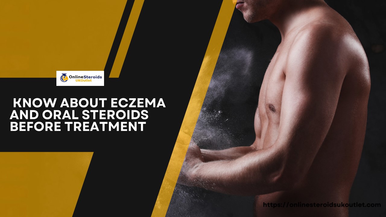 Know About Eczema and Oral Steroids Before Treatment