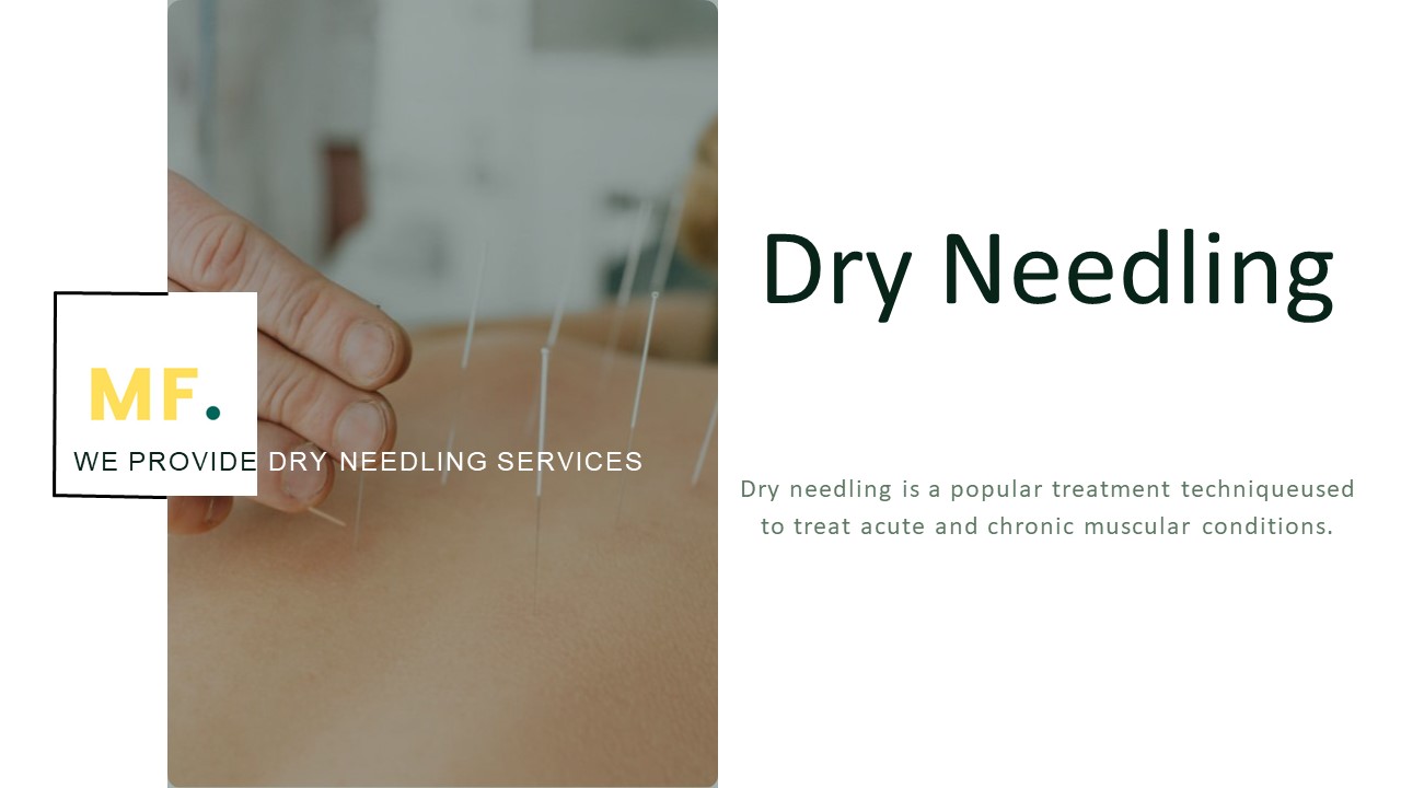 Get Pain Relief by Dry Needling - Best Massage Melbourne CBD