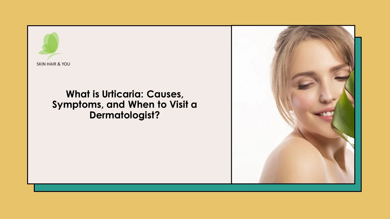 Discover the Urticaria Symptoms, And find out When to See a Dermatologist