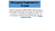 Melasma Treatment In Dubai