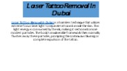 Laser Tattoo Removal In Dubai