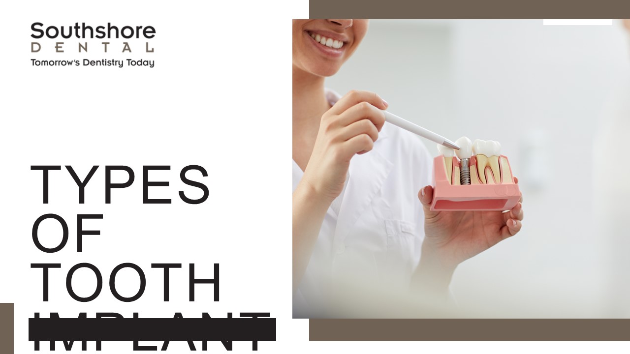 Experience a New Level of Confidence with Dental Implants