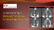 Understanding A Dobutamine Stress Echocardiography Test