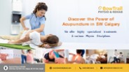 Discover the Power of Acupuncture in SW Calgary