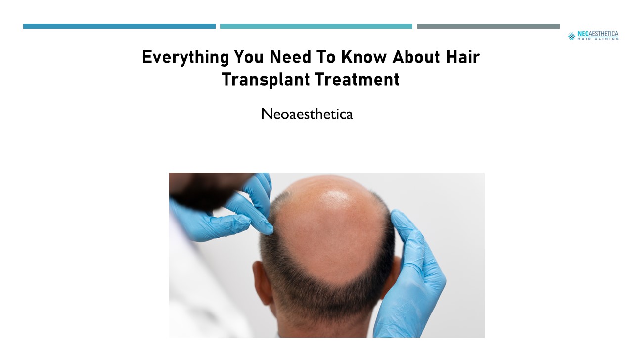 Everything You Need To Know About Hair Transplant Treatment