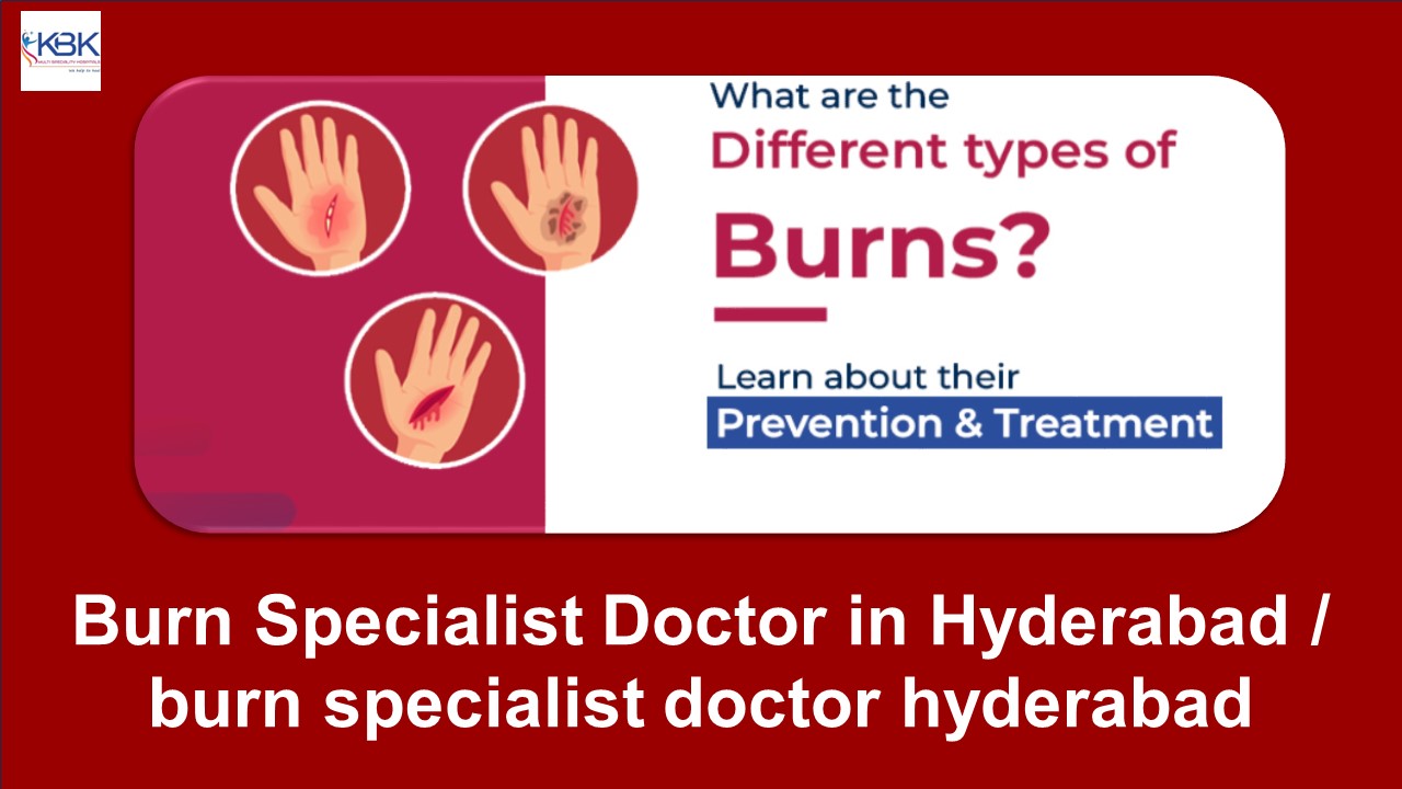 Burn Specialist Doctor in Hyderabad