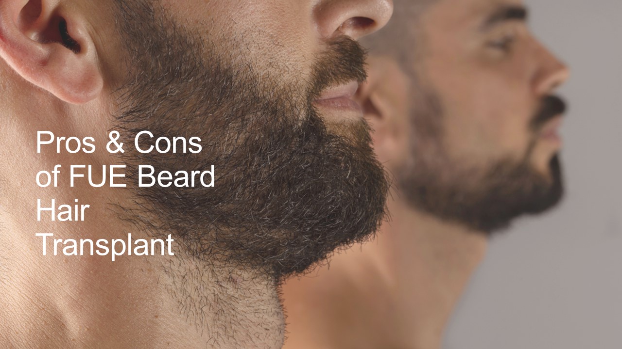 Pros & Cons of FUE Beard Hair Transplant
