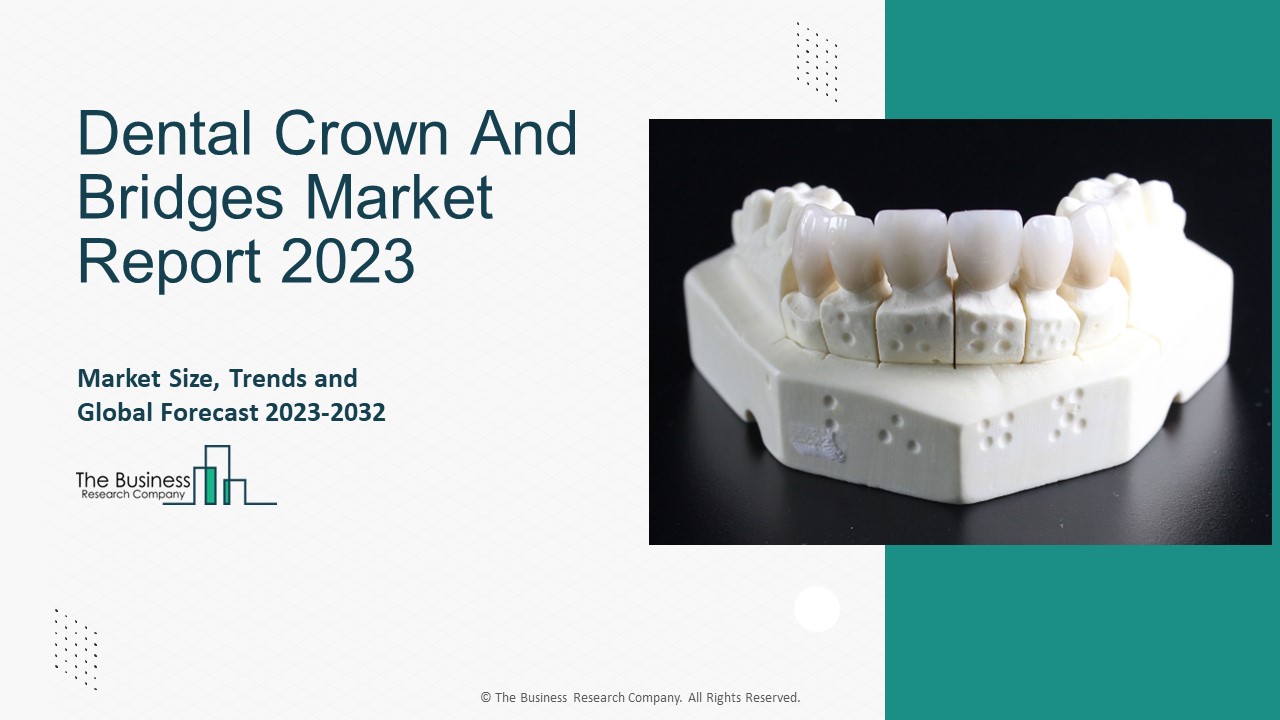 PPT – Dental Crown And Bridges Market Segmentation, Business Growth ...