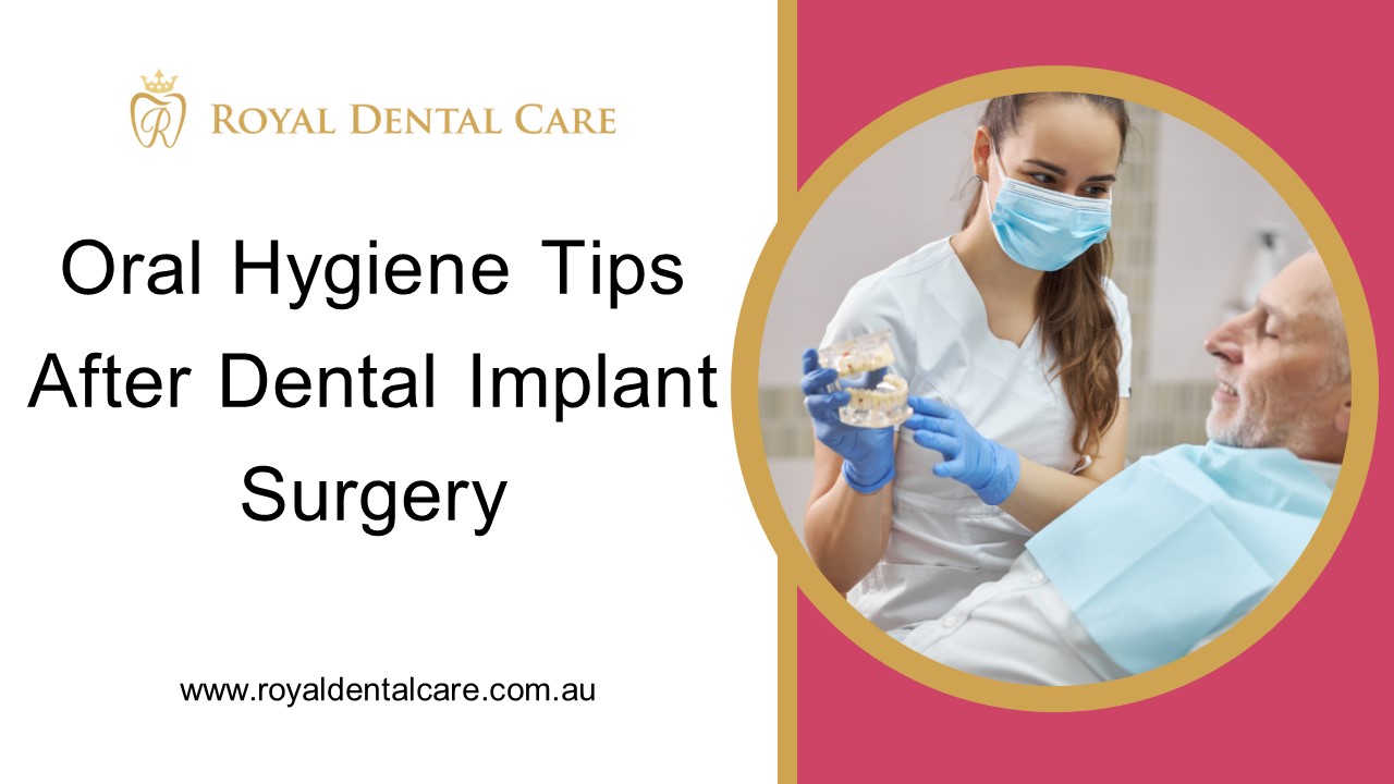 Oral Hygiene Tips after Dental Implant Surgery