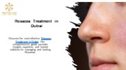 Rosacea Treatment in Dubai