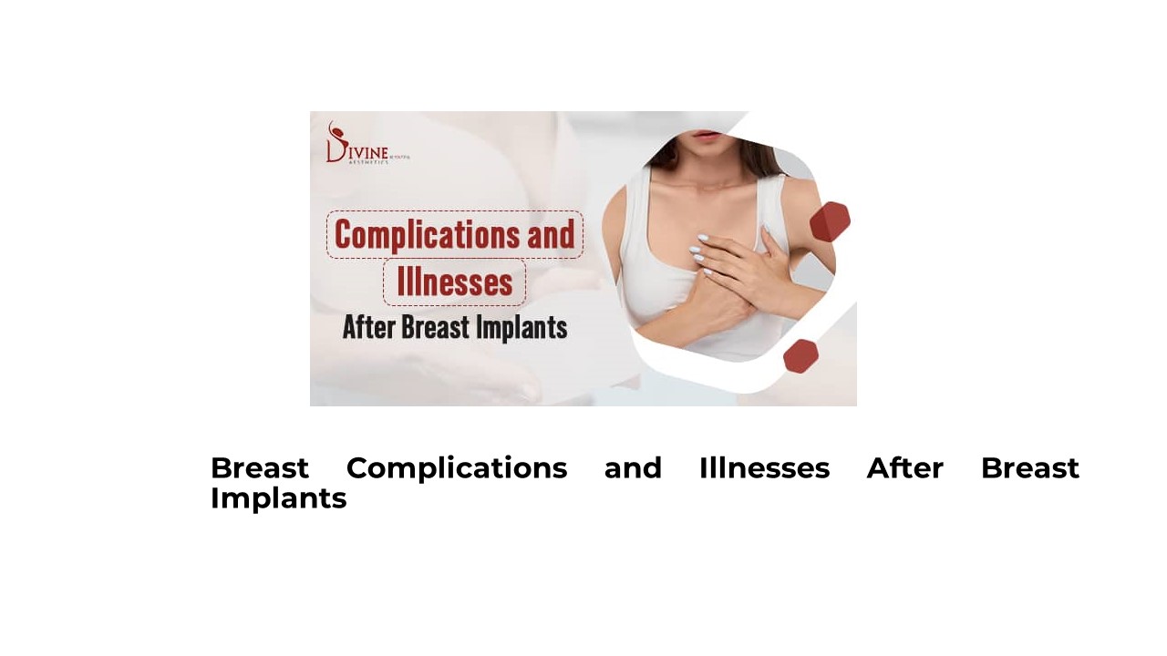 What Are the Complications and Illnesses After Breast Implants?