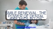 Smile Renewal The Power of Dental Implants in Los Angeles