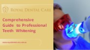 Comprehensive Guide to Professional Teeth Whitening